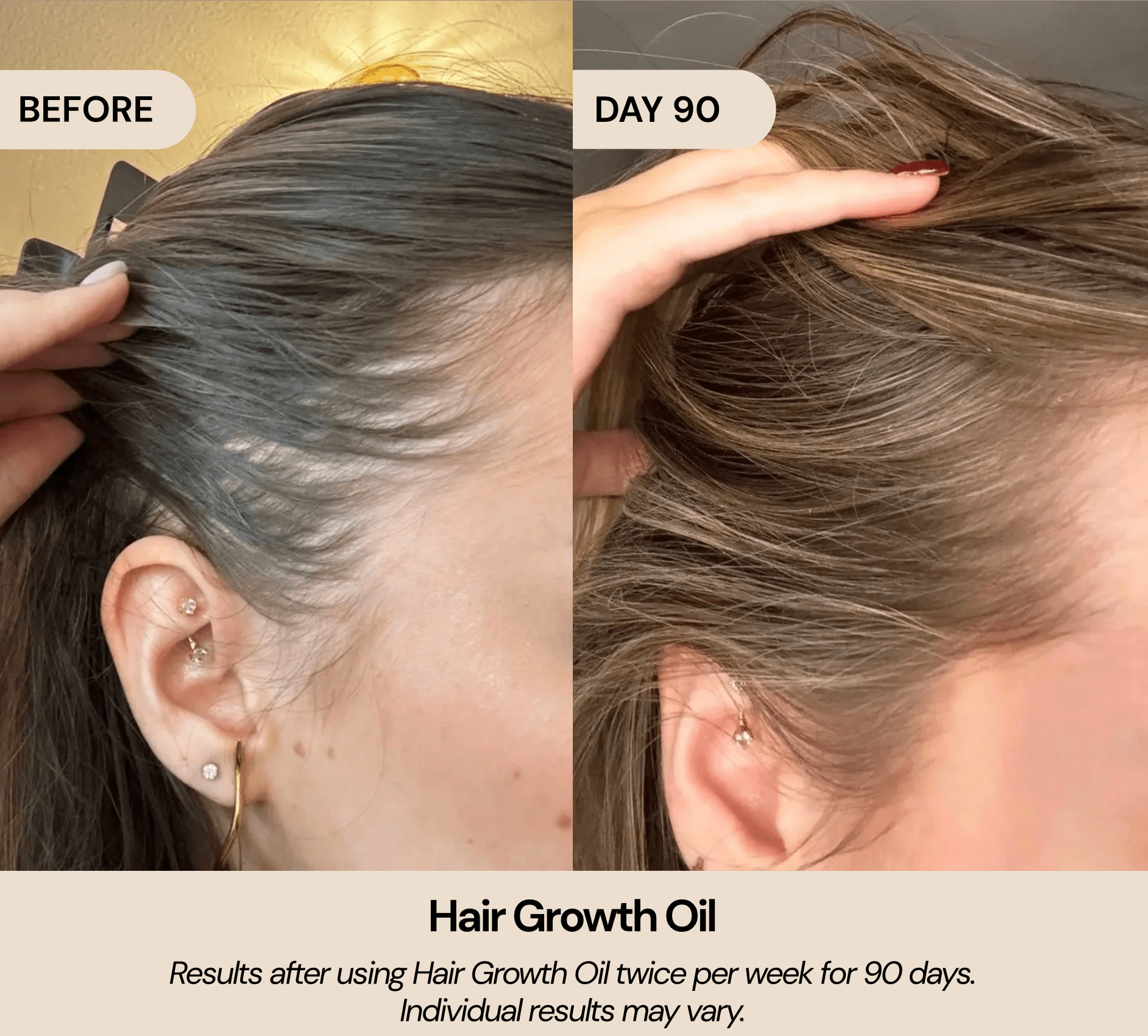 Hair Growth Oil - LuckyBirdForever® – Official Store