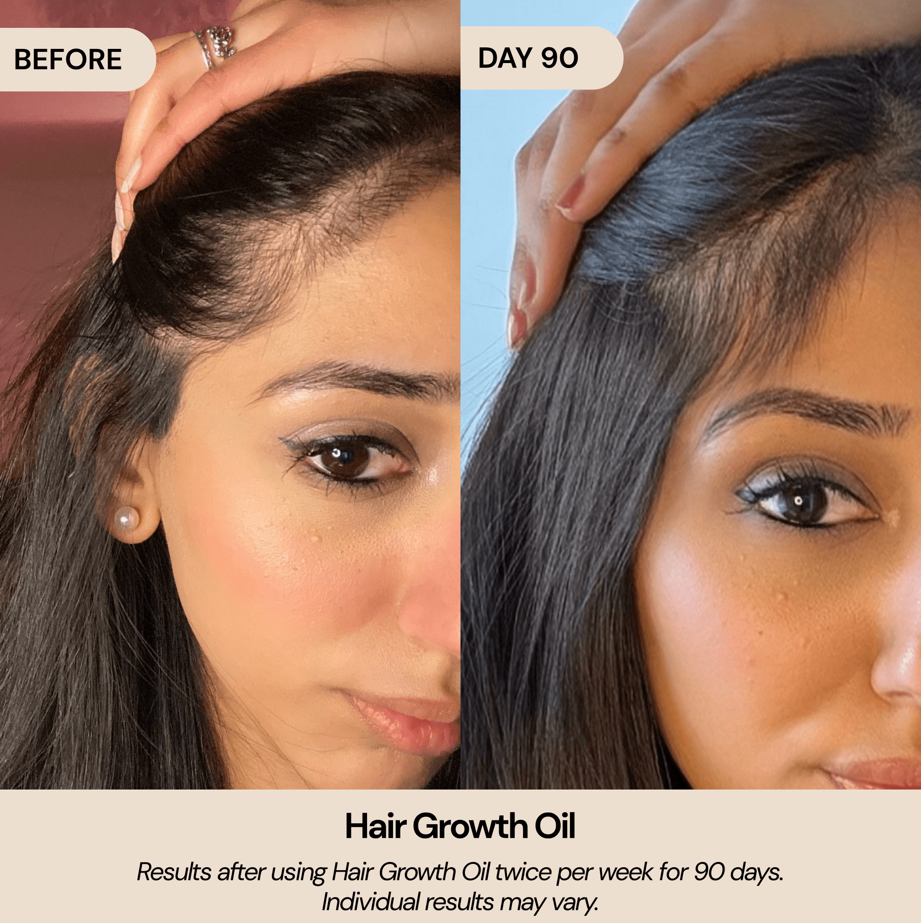 Hair Growth Oil - LuckyBirdForever® – Official Store